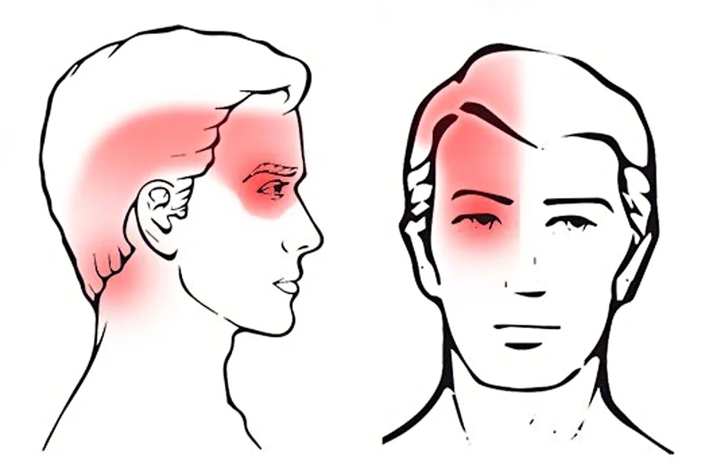 Cervicalogenic Headaches Treatment In Gurgaon